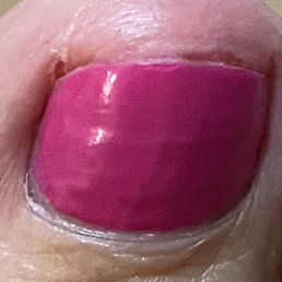 bloody toe bloody toe