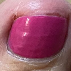 Eros Nail Spa - Bloody toe