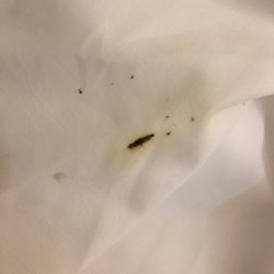 Dunes Properties - Folly Beach Office - The rental office says we are mistaken.....this is not feces......