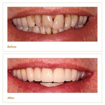 Goldie Dixit ,DDS - Photo - General Dentistry Near Me - Smiths Falls, Ontario