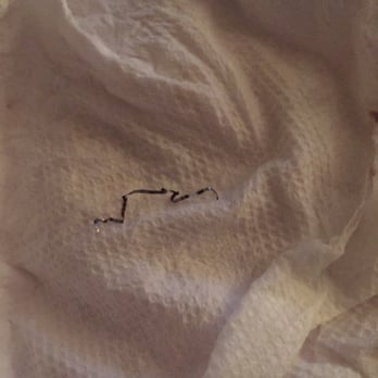 Nikko Hibachi - Piece of metal found in food. - Japanese Near Me - Fresh Meadows, New York Nikko Hibachi - Piece of metal found in food. - Japanese Near Me - Fresh Meadows, New York