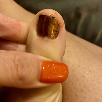 Nails of US - Bad polish job and torn nail - Nail Salons Near Me - Lady Lake, Florida Nails of US - Bad polish job and torn nail - Nail Salons Near Me - Lady Lake, Florida