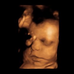 Maternal-Fetal Medicine Associates of Sacramento | Stockton - Happy to announce we finally received the clearance to see ob only now! Thank you Perinatal Associates Sacramento