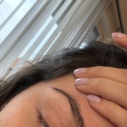 Lilac Spa - Popped blood vessels from the massage