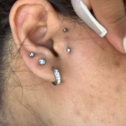 Surface tragus piercing. ( you can see the scarring from my original piercer) Surface tragus piercing. ( you can see the scarring from my original piercer)