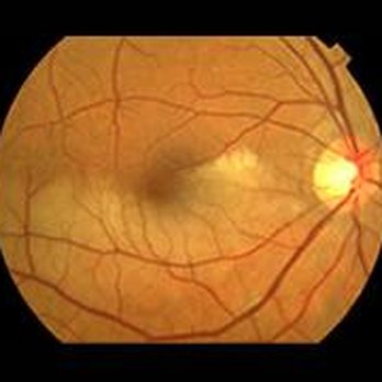Mid Atlantic Retina - Retina Specialists Near Me - Bethlehem, Pennsylvania Mid Atlantic Retina - Retina Specialists Near Me - Bethlehem, Pennsylvania
