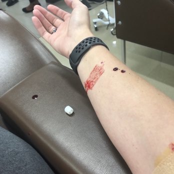 BioLife Plasma Services - Messed up stick. My other arm had already been botched too this time. - Blood & Plasma Donation Centers Near Me - Glendale, Arizona