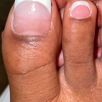 Ten Perfect Nails Salon - In this photo you can clearly see where my natural toenail and the acrylic meet, no one should be able to see this. - Nail Salons Near Me - Pensacola, Florida Ten Perfect Nails Salon - In this photo you can clearly see where my natural toenail and the acrylic meet, no one should be able to see this. - Nail Salons Near Me - Pensacola, Florida