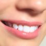 Photo of Dentalis