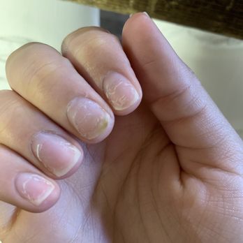 Gel Nails & Spa - Green spot on middle finger (grown out) - Waxing Near Me - Portsmouth, New Hampshire Gel Nails & Spa - Green spot on middle finger (grown out) - Waxing Near Me - Portsmouth, New Hampshire