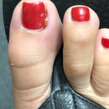 Pearl Nails - Infection - Nail Salons Near Me - Rosemead, California Pearl Nails - Infection - Nail Salons Near Me - Rosemead, California