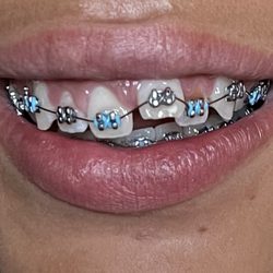 Apple Valley Orthodontics
