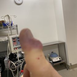 Kaiser Permanente Farmers Market - Plastic surgery on finger. Damage from PC gaming... never playing another video game again!
