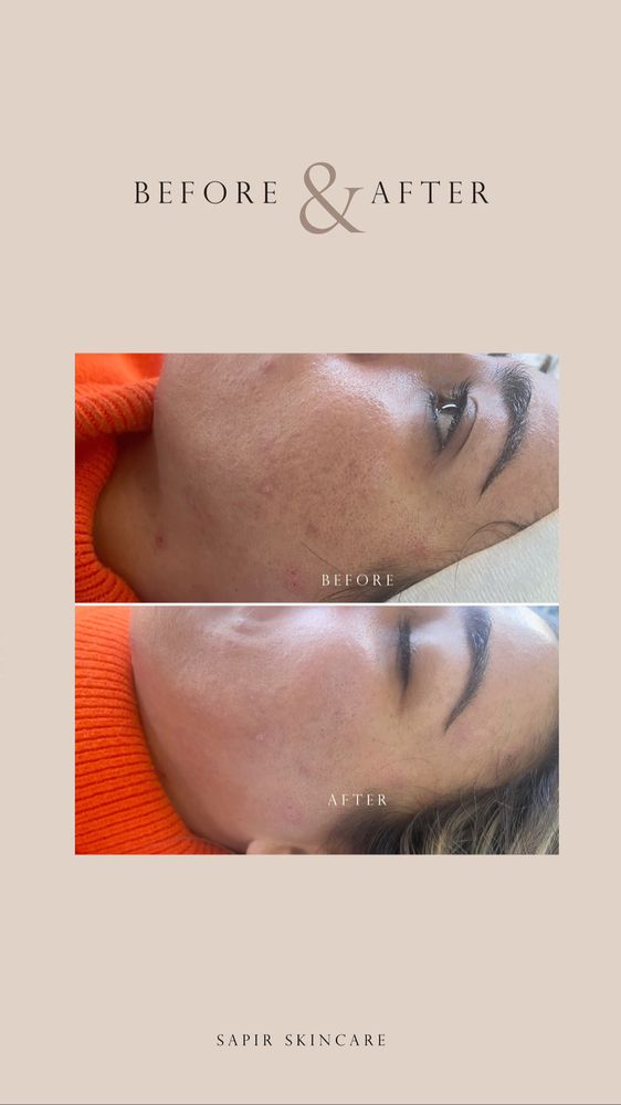 Sapir Skin Care Logo