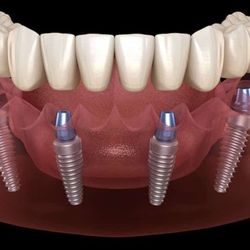 Coleman's Dental Studio