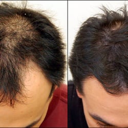 Great Hair Restoration of Oklahoma