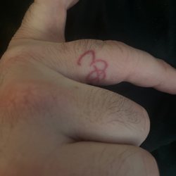 LaserAll Fort Collins - 1x1 inch tattoo