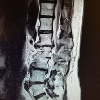 Desert Orthopedic Center - Lower spine - Orthopedists Near Me - Las Vegas, Nevada Desert Orthopedic Center - Lower spine - Orthopedists Near Me - Las Vegas, Nevada