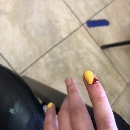 Her nail bleeding