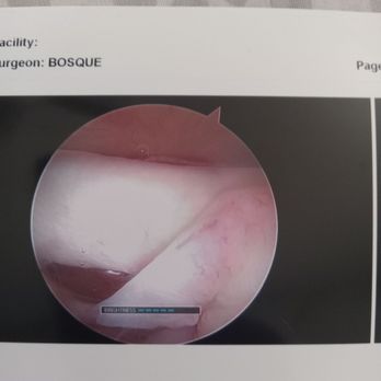 Adventist Health Bakersfield - Inside my shoulder after surgery. - Medical Centers Near Me - Bakersfield, California Adventist Health Bakersfield - Inside my shoulder after surgery. - Medical Centers Near Me - Bakersfield, California