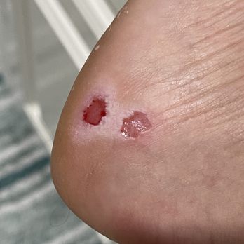 Beauty Nail Bar - Deep gashes on my foot. Flip flops are all I can wear and walking hurts - Nail Salons Near Me - Cypress, Texas Beauty Nail Bar - Deep gashes on my foot. Flip flops are all I can wear and walking hurts - Nail Salons Near Me - Cypress, Texas