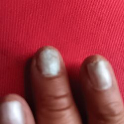 After so called manicure