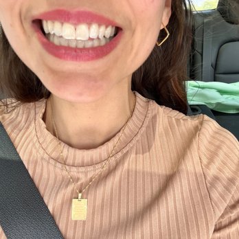 Casa Dental - After cleaning - Cosmetic Dentists Near Me - Escondido, California Casa Dental - After cleaning - Cosmetic Dentists Near Me - Escondido, California