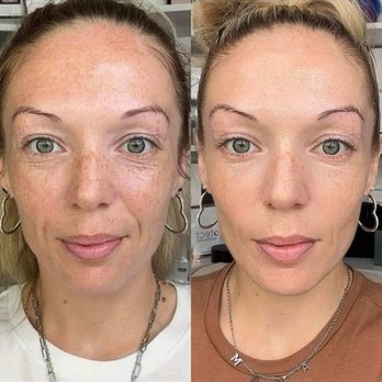 Simply Skin - Skin Care Near Me - Westport, Connecticut Simply Skin - Skin Care Near Me - Westport, Connecticut