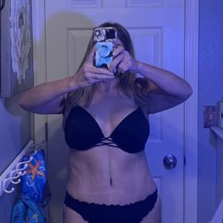 Jana Cole, MD - 6 weeks post surgery
