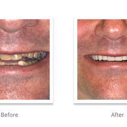 Elite Dental