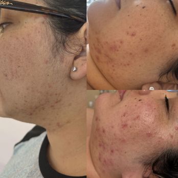 Crystallesthetics - Skin Care Near Me - Fullerton, California Crystallesthetics - Skin Care Near Me - Fullerton, California