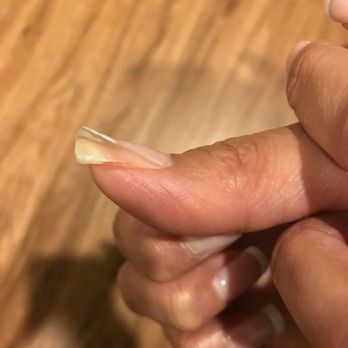 Brio Spa and Nail Salon - Another pic of the gel lifting from the right thumb after less than a week being done at Brio. Wow! Unbelievable! - Nail Salons Near Me - Marlton, New Jersey