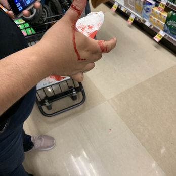 Ralphs - Would not stop bleeding - Grocery Near Me - Van Nuys, California