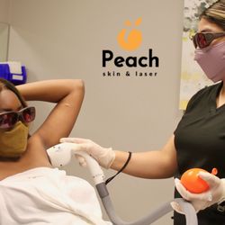 Peach Skin & Laser