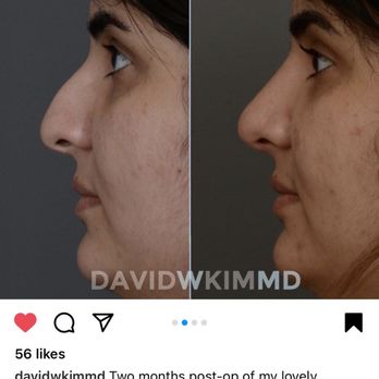 DAVID W KIM, MD - Updated May 2025 - 345 Photos & 211 Reviews - 55 ...