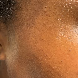 Le Lux Beautique - Incomplete dermaplane