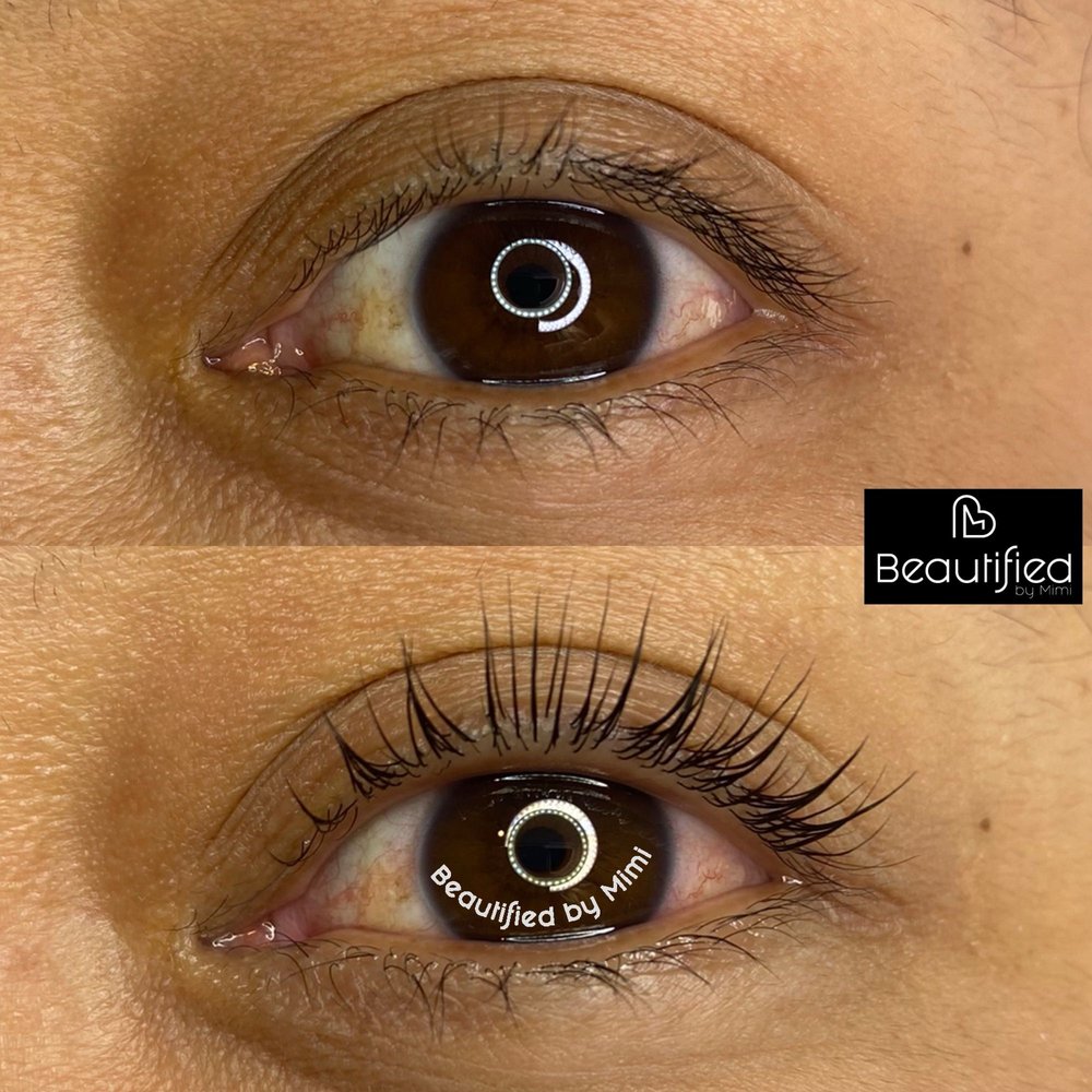 Beautified - This was taken the day of my appointment - Skin Care Near Me - La Mesa, California