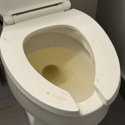 Springfield Rehabilitation & Healthcare Center - Just one example of the deplorable conditions during my aunt's stay at SRC.