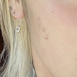 Charles Chiang, MD - Skin before