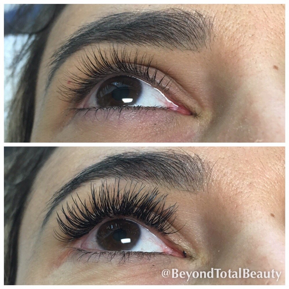 Beyond Total Beauty Logo