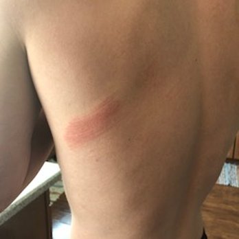 Ohio Mobile Gaming - scratches were on all the kids from the velcro. - Party & Event Planning Near Me - Willoughby, Ohio