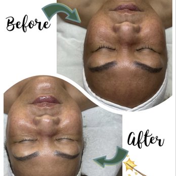 Be Bare Skin - Brightening facial - Skin Care Near Me - Agoura Hills, California Be Bare Skin - Brightening facial - Skin Care Near Me - Agoura Hills, California