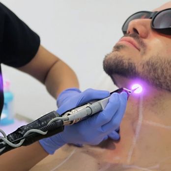 Painless For Men Who Want To Get Rid Of Stubborn Ingrown Hair For