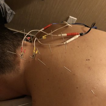 Yupo Health - Acupuncture Near Me - New York, New York Yupo Health - Acupuncture Near Me - New York, New York