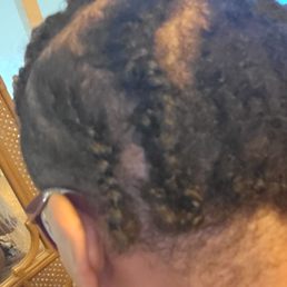 This is the back of my head after three weeks. The twisted down section is 3 to 4 inches long. This is the back of my head after three weeks. The twisted down section is 3 to 4 inches long.