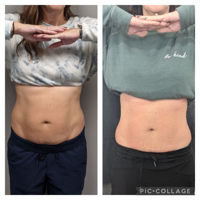 Inspired Beauty Med Spa