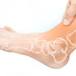 Indy Myopain Relief Center - Foot pain vanishes with Indy Myopain Relief treatments, no medication or surgery.