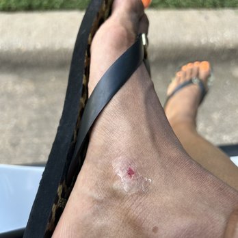 Texas Nail Bar - The wound after it stopped bleeding. - Nail Salons Near Me - Euless, Texas Texas Nail Bar - The wound after it stopped bleeding. - Nail Salons Near Me - Euless, Texas