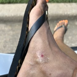 Texas Nail Bar - The wound after it stopped bleeding.