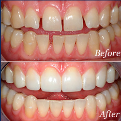 Heavenly Smiles Dental